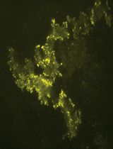 Applications of OptoProfilin in Living Cells for the Imaging of Focal Adhesions and Stress-Associated Phenotypes