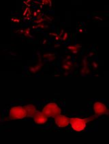 A Simplified Density Gradient–Free Method for Isolating Functional Symbiosomes From Legume Nodules