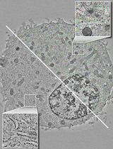 Semi-Automated Workflow for Segmenting and Quantifying Ribosomes in Electron Tomograms of High-Pressure Frozen and Resin-Embedded Samples