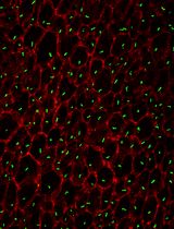 TurboID-Mediated Proteomic Study in the Primary Cilia of Embryonic Mouse Brain