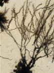 Neuronal Morphology Analysis