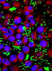 Adherent-invasive Escherichia coli Biofilm Formation Assays