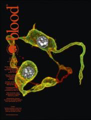 Cover of Blood, featuring study using the protocol.