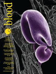 Cover of Blood, featuring study using the protocol.