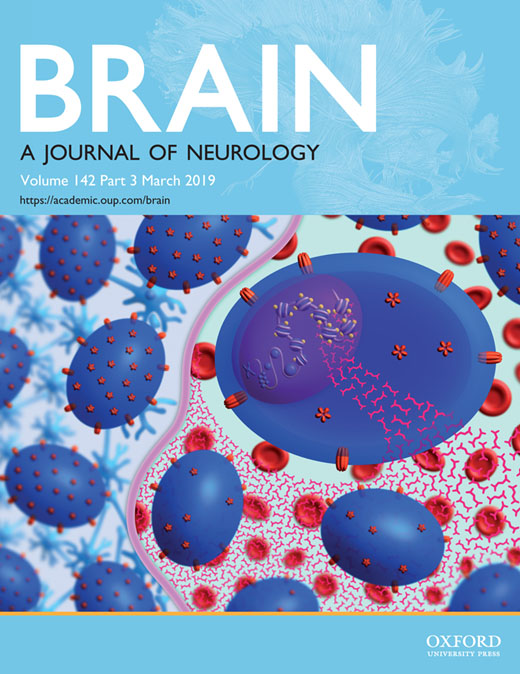 Cover of Brain, featuring study using the protocol.
