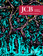Cover of The Journal of Cell Biology, featuring study using the protocol.
