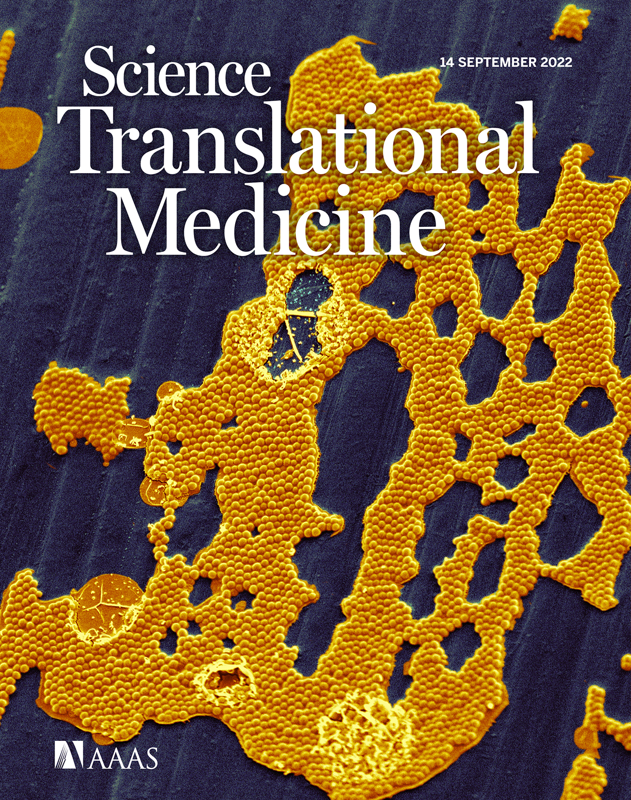Cover of Science Translational Medicine, featuring study using the protocol.