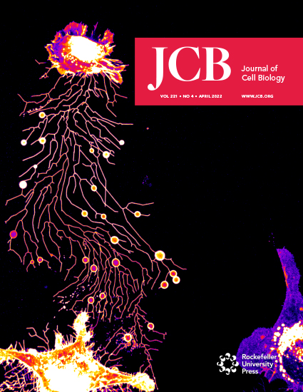 Cover of The Journal of Cell Biology, featuring study using the protocol.
