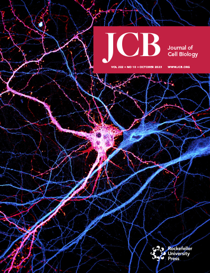 Cover of The Journal of Cell Biology, featuring study using the protocol.