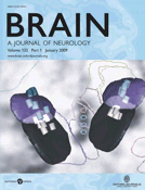 Cover of Brain, featuring study using the protocol.