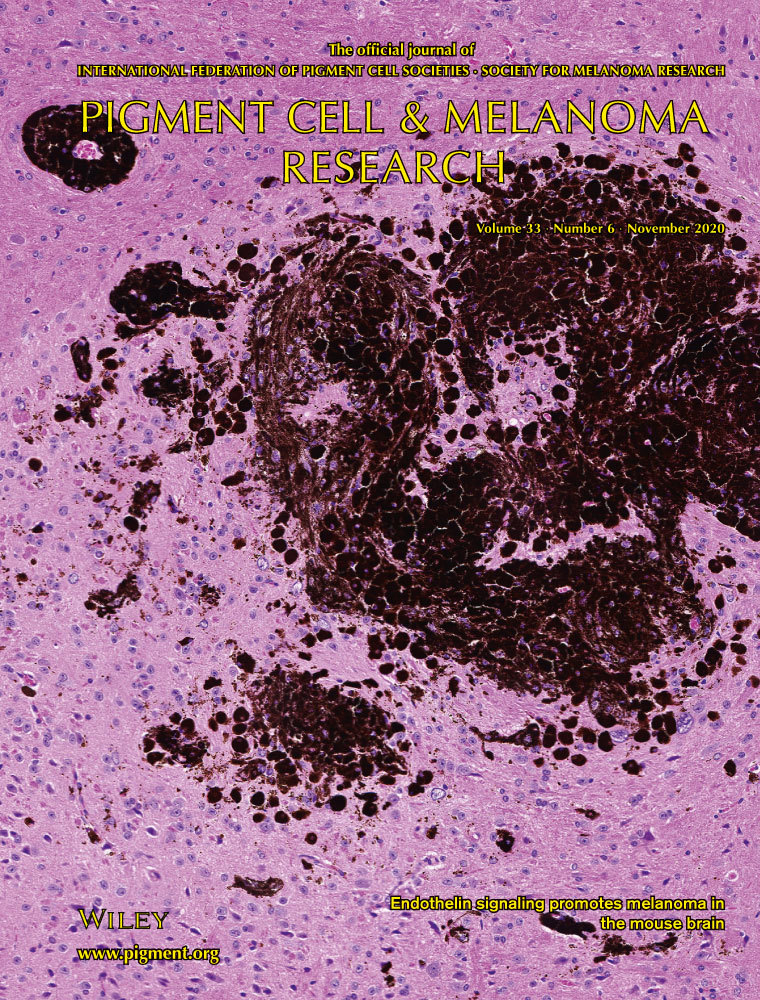 Cover of Pigment Cell and Melanoma Research, featuring study using the protocol.