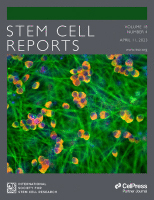 Generation of Functional Patient-Specific Thymus Organoids From Human Pluripotent Stem Cells (hPSCs) Using Air–Liquid Interface Culture