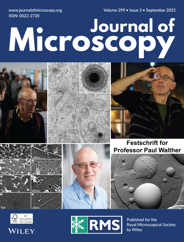 Cover of Journal of Microscopy, featuring study using the protocol.